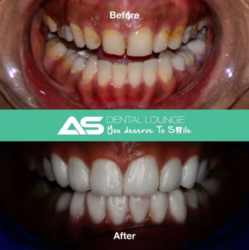 Slider image (2) AS Dental Lounge